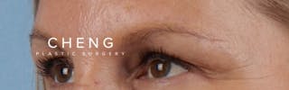 Hidden Patients Before & After Gallery - Patient 283134 - Image 6