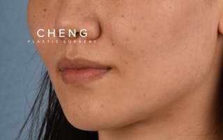 Hidden Patients Before & After Gallery - Patient 349943 - Image 8