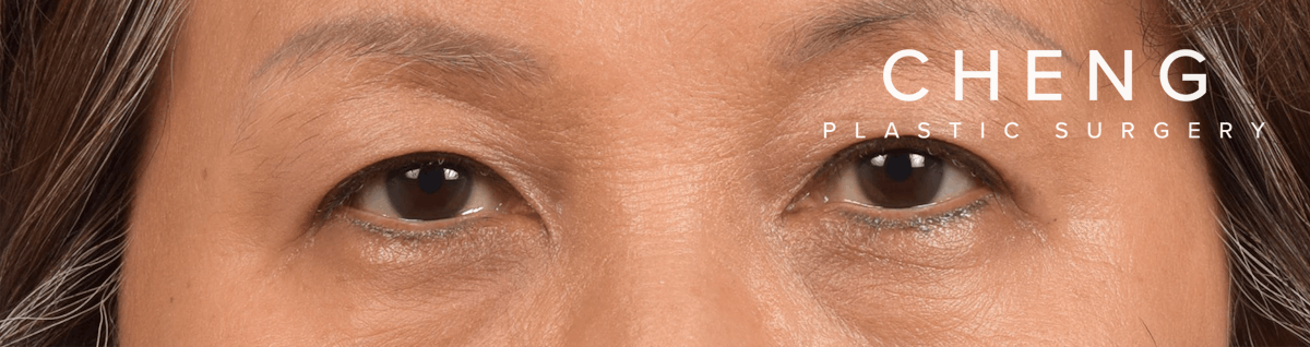 Hidden Patients Before & After Gallery - Patient 947245 - Image 2