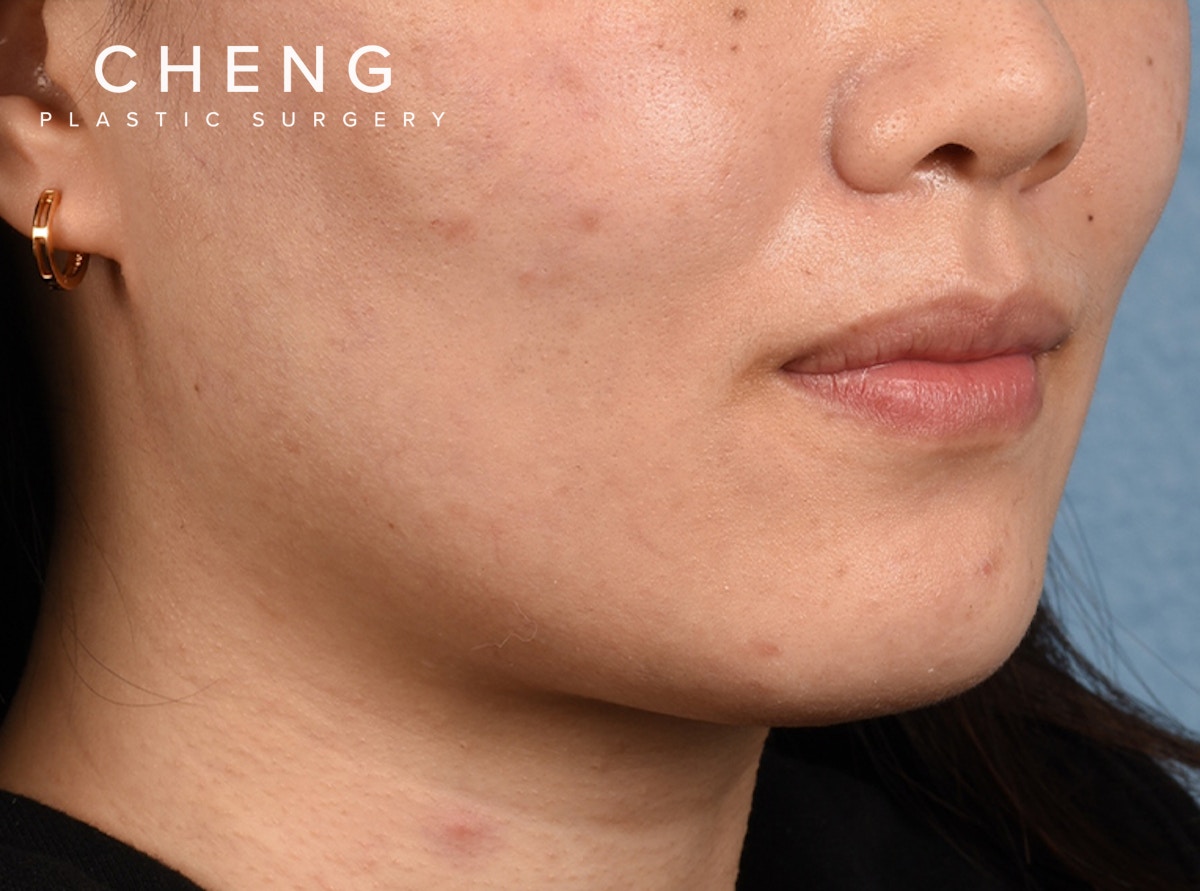 Hidden Patients Before & After Gallery - Patient 146208 - Image 9