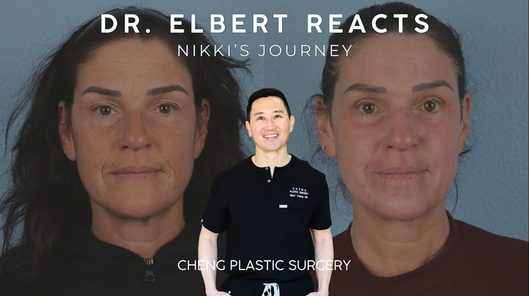 Cheng Plastic Surgery