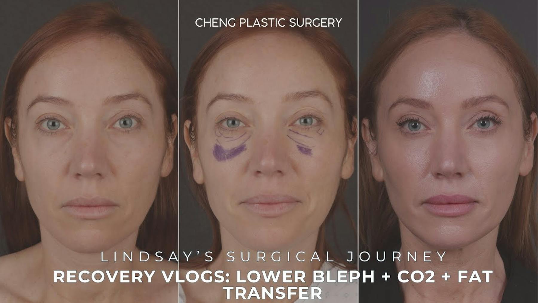 Cheng Plastic Surgery