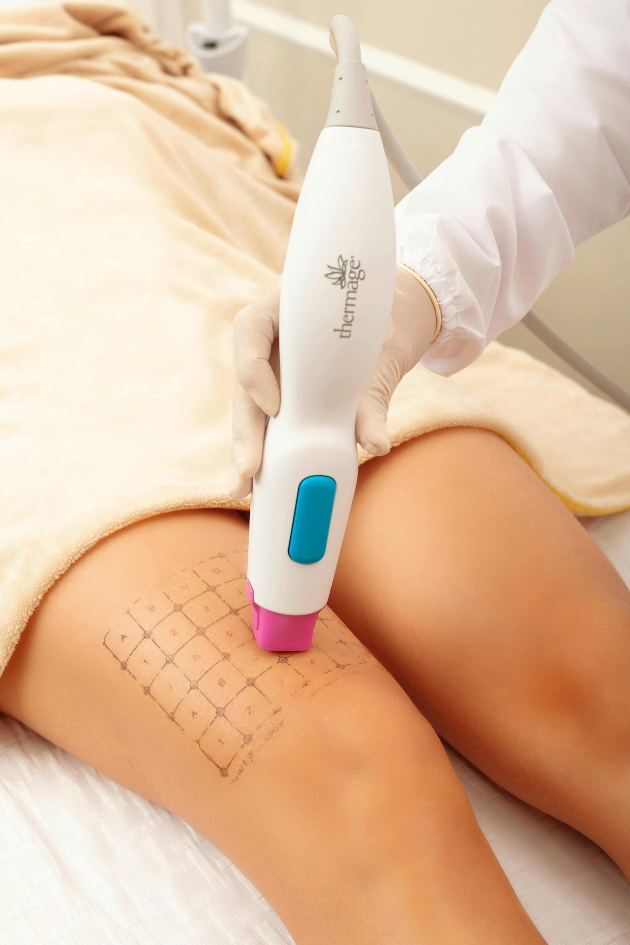 Leg getting laser procedure, representing body contouring