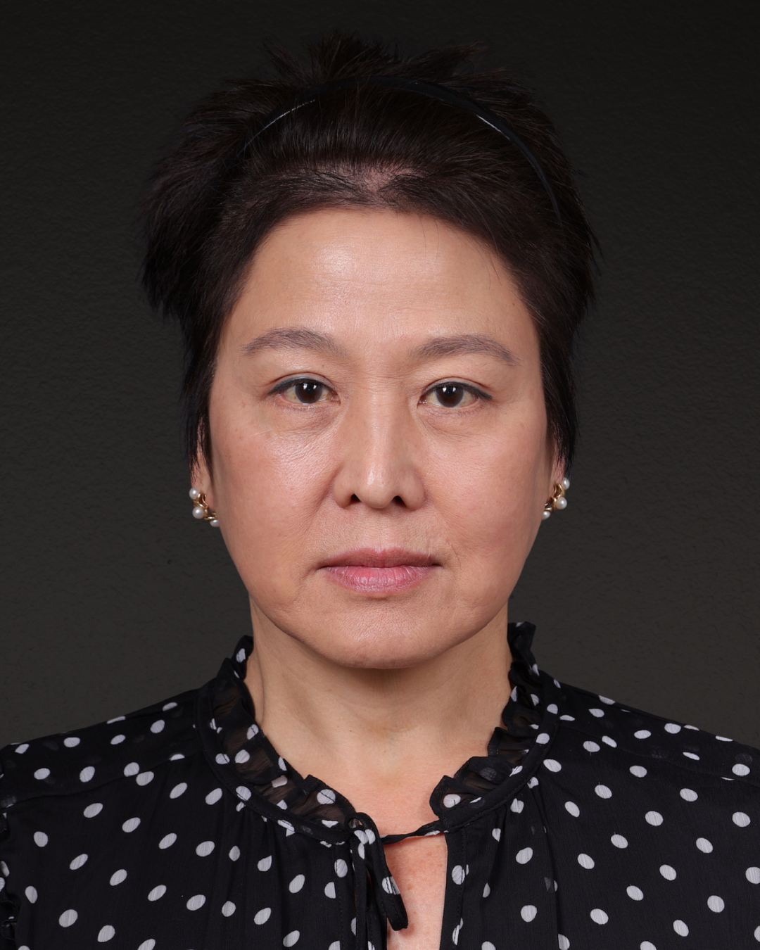 Facelift Before & After Gallery - Patient 285357 - Image 2