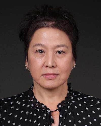 Facelift Before & After Gallery - Patient 285357 - Image 2