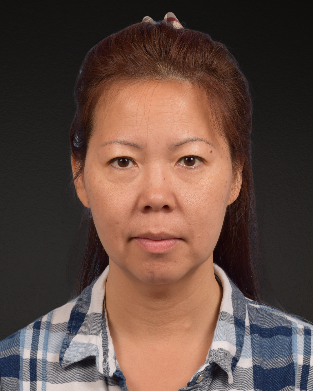 Facelift Before & After Gallery - Patient 384291 - Image 1