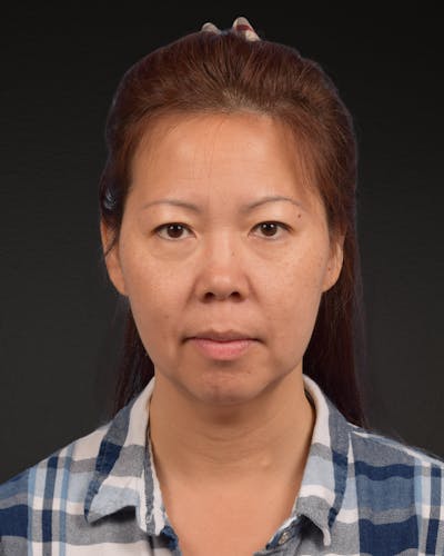 Facelift Before & After Gallery - Patient 384291 - Image 1