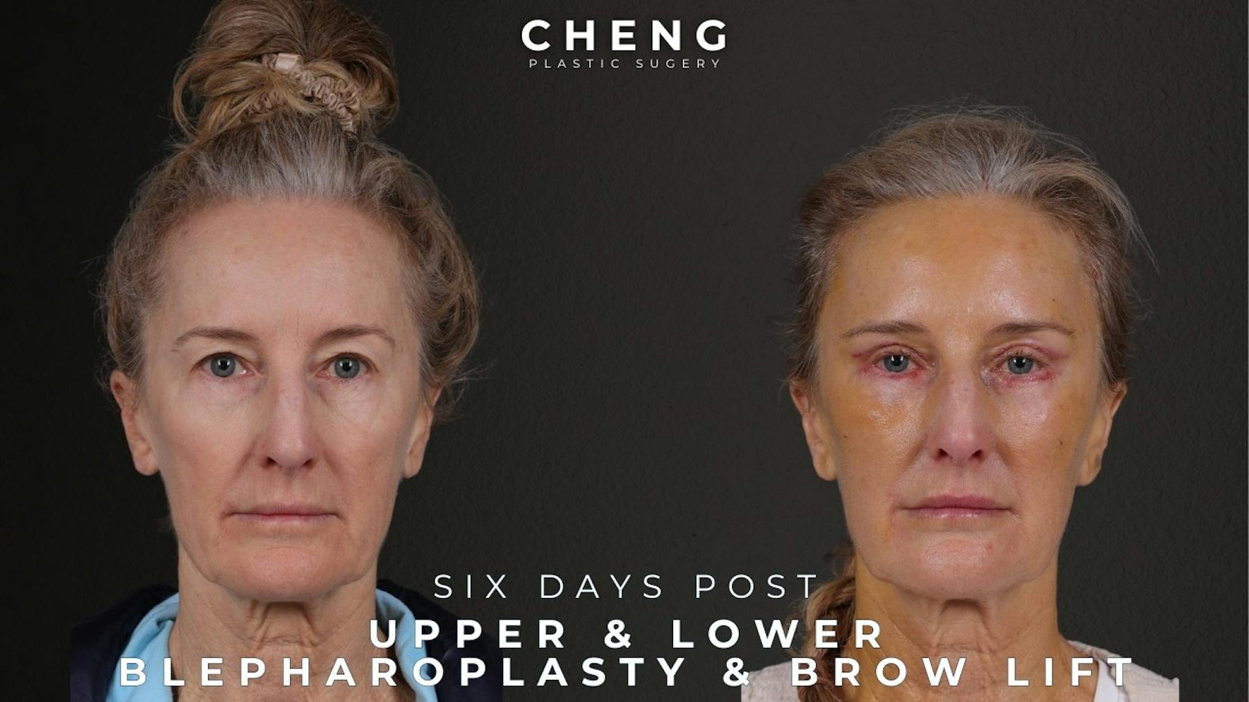 Cheng Plastic Surgery