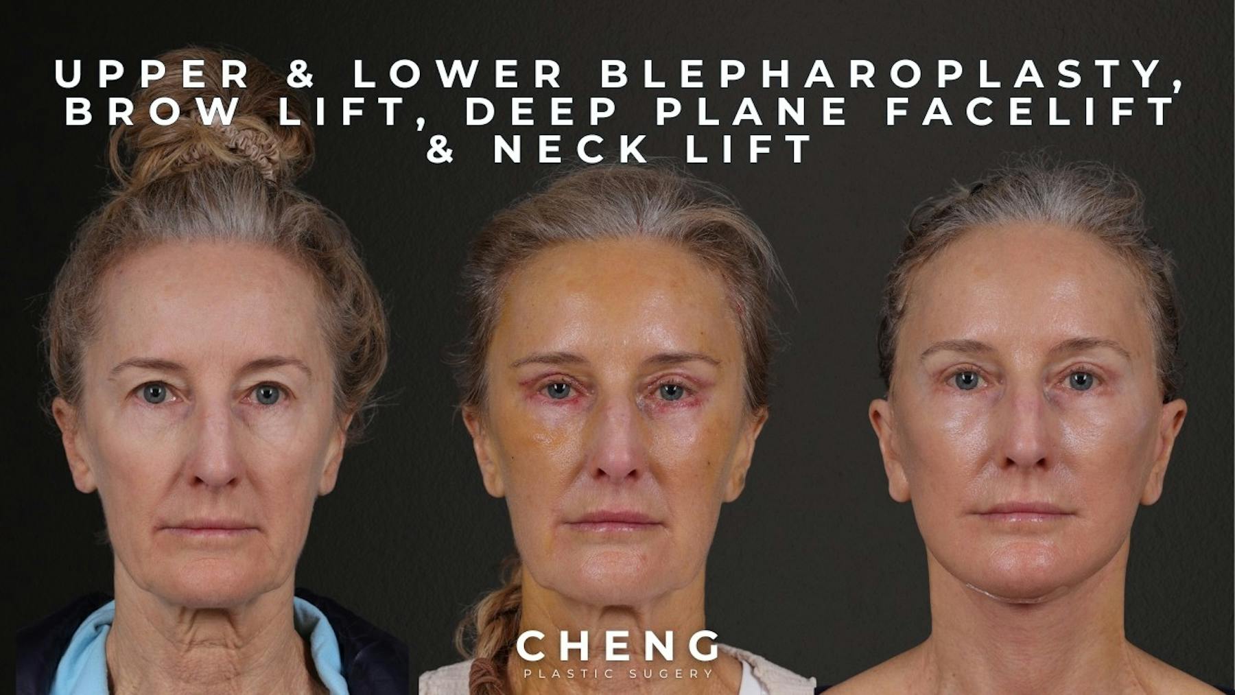 Cheng Plastic Surgery