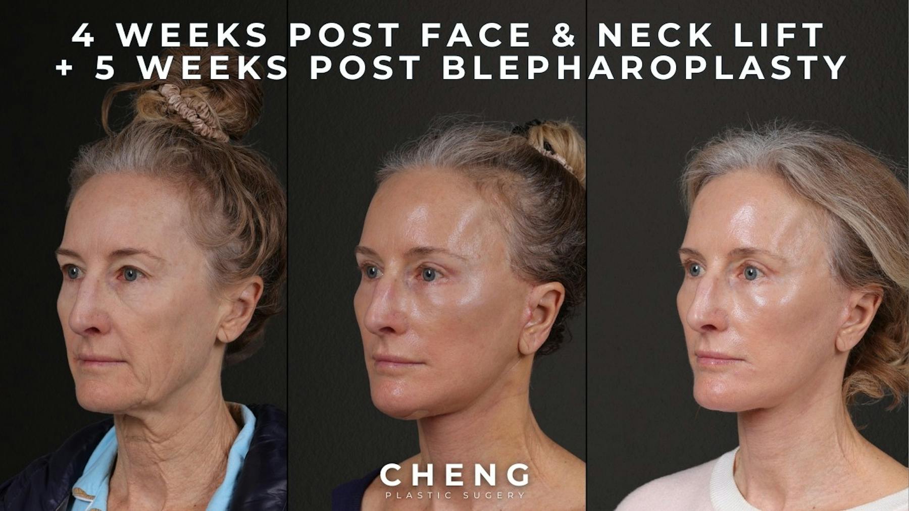 Cheng Plastic Surgery