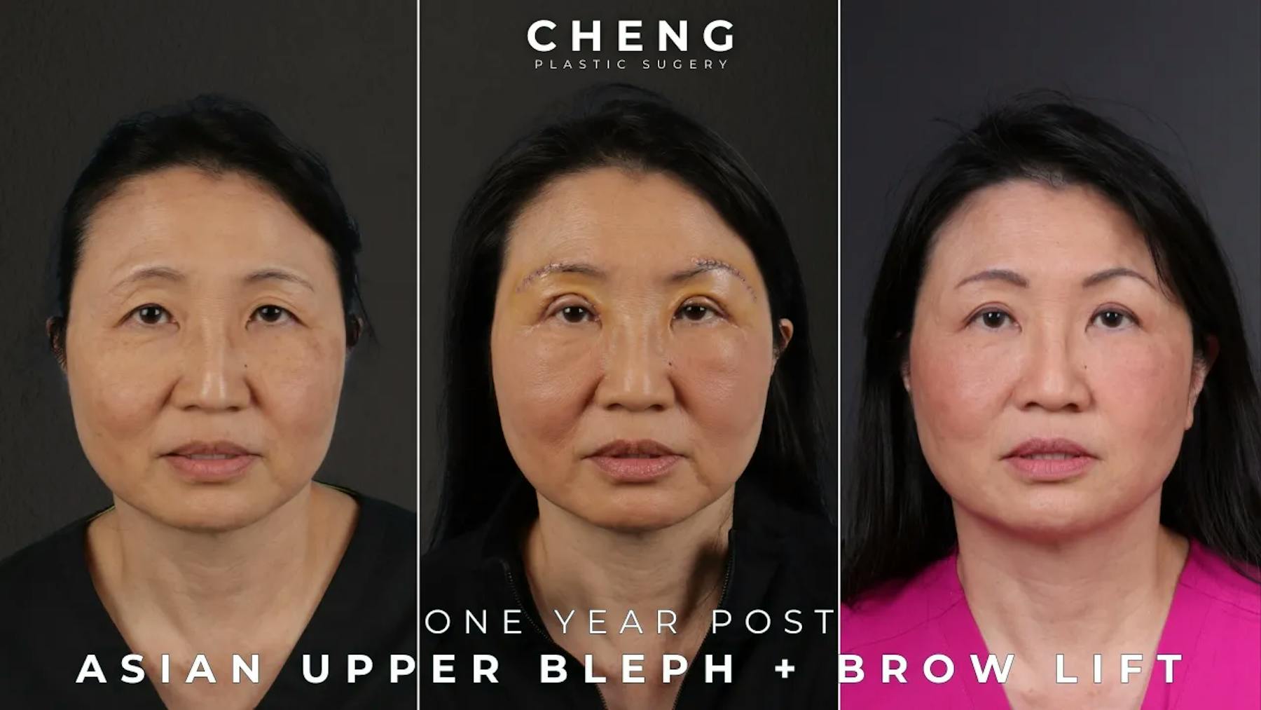 Cheng Plastic Surgery