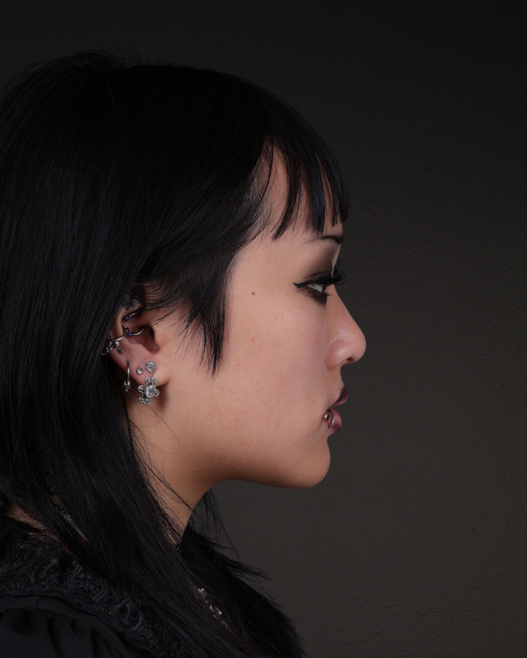 Rhinoplasty Before & After Gallery - Patient 113225 - Image 2