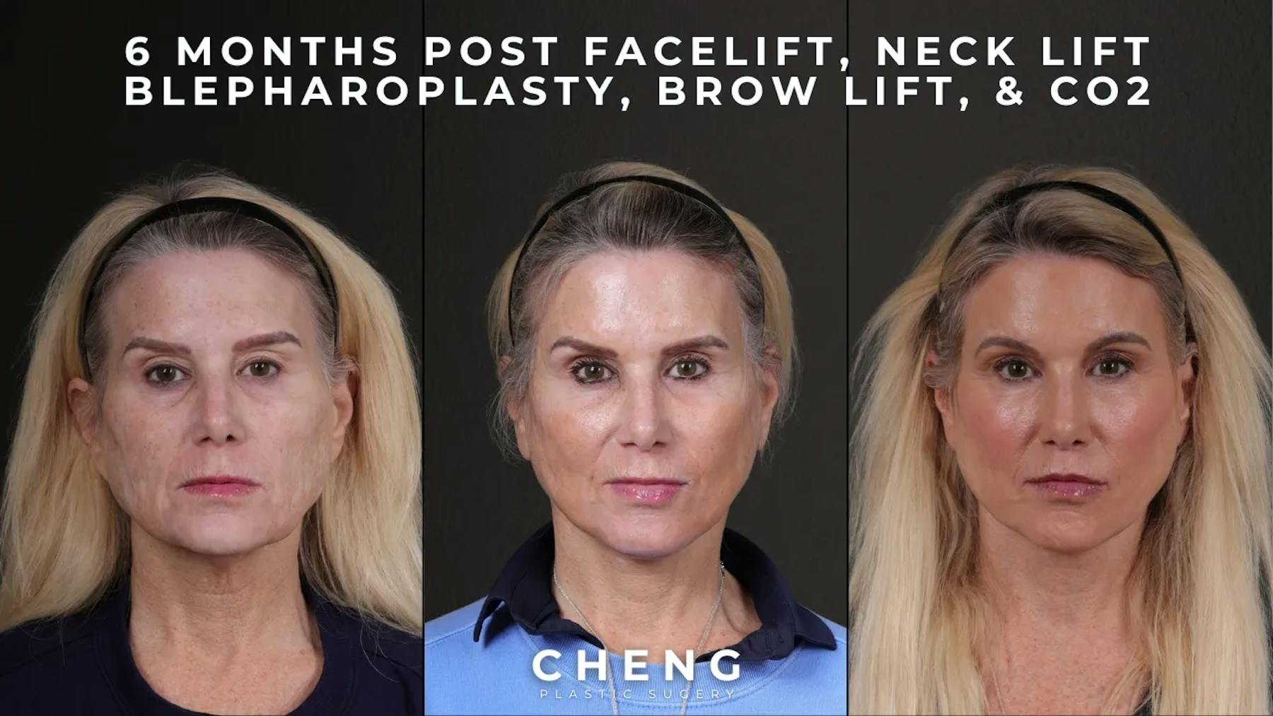 Cheng Plastic Surgery