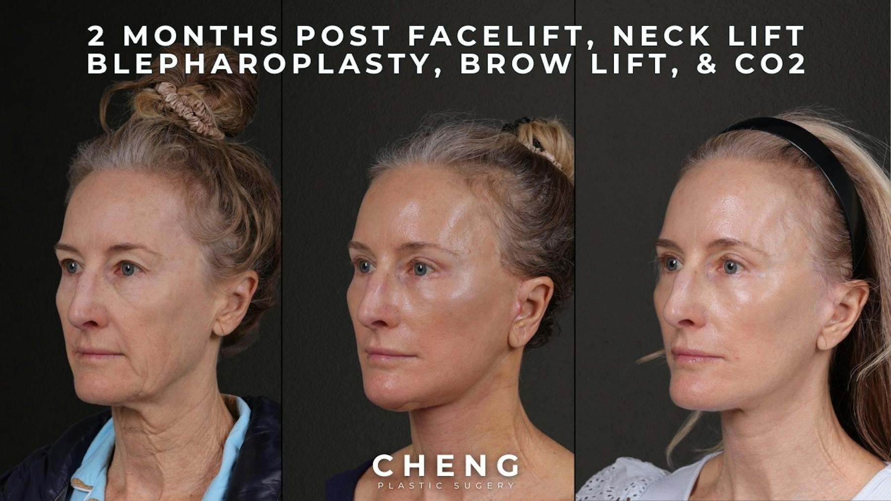 Cheng Plastic Surgery