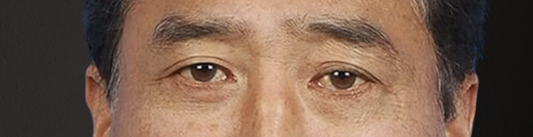 Blepharoplasty Before & After Gallery - Patient 481320 - Image 2