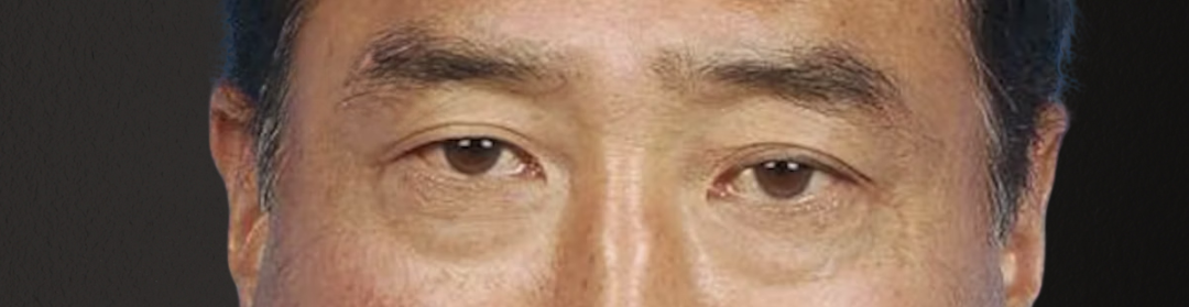 Blepharoplasty Before & After Gallery - Patient 481320 - Image 1