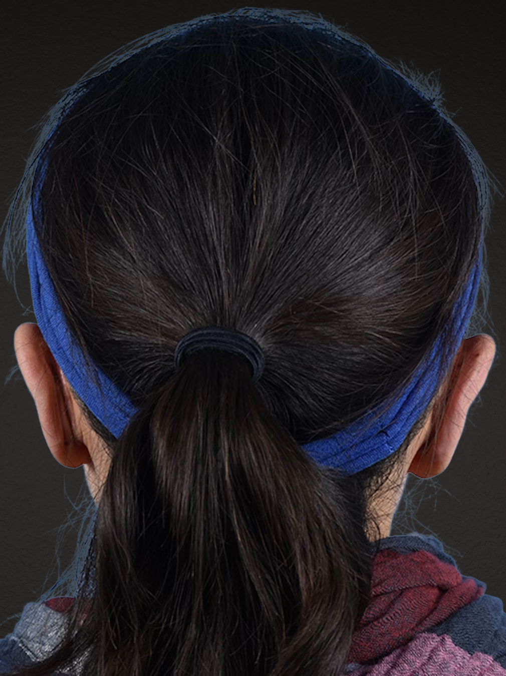 Otoplasty Before & After Gallery - Patient 260468 - Image 1