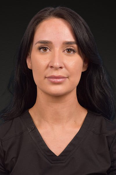 Botox and Dysport Before & After Gallery - Patient 144622 - Image 1