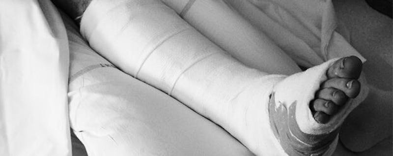 Leg in a Cast