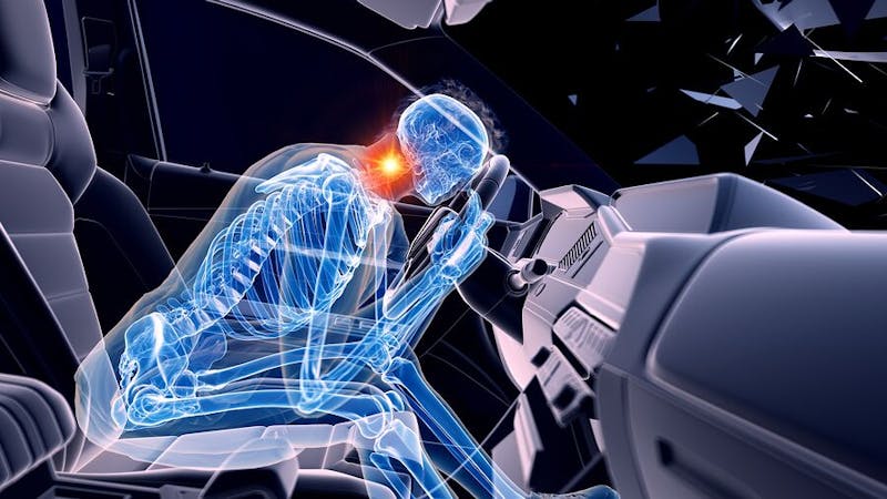 Diagram of a person hitting a steering wheel in a car crash