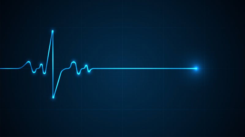 A flat line on a heart monitor