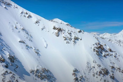 'Ups and Downs': Drew Petersen opens up about his mental health