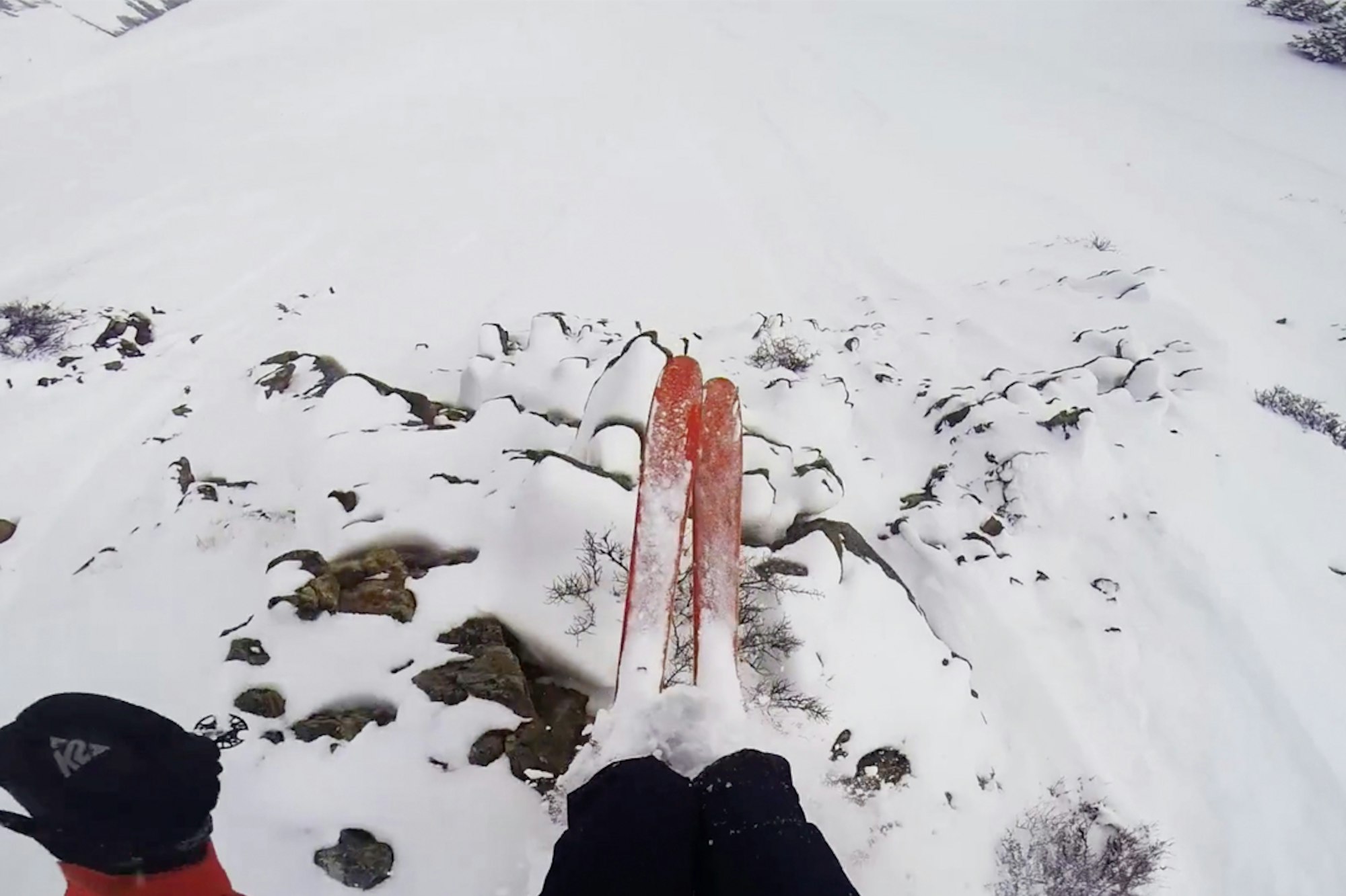 Ever been injured on skis? This video is for you