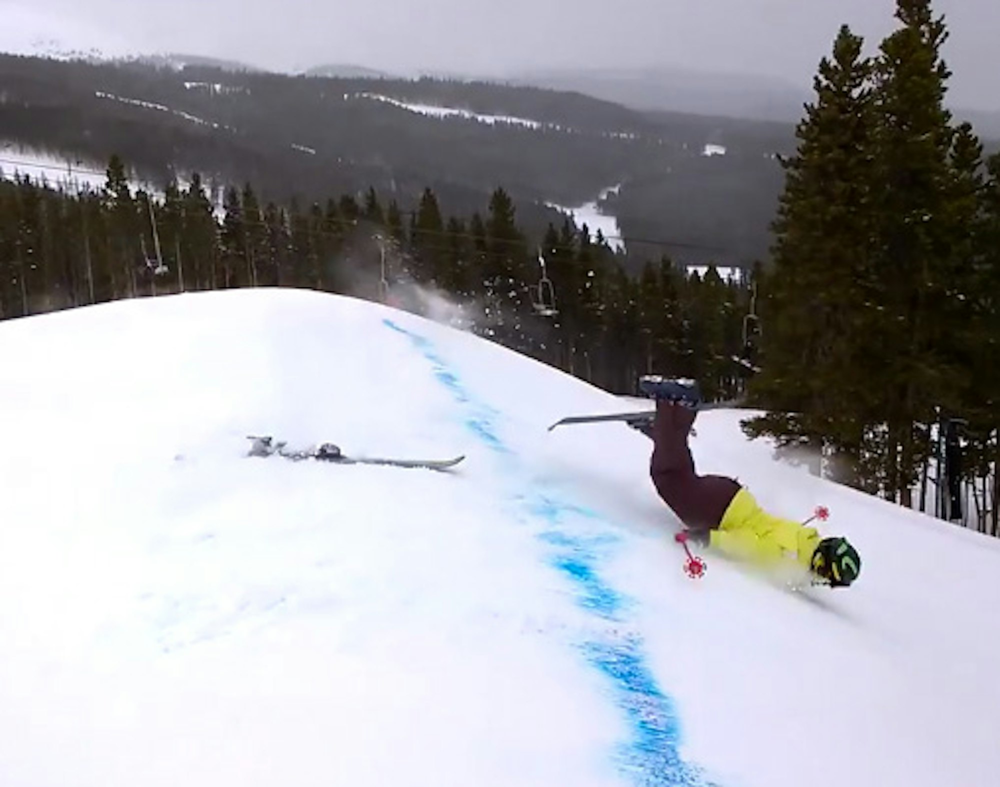 "Gutsy mom tries terrain park," and things don't go very well