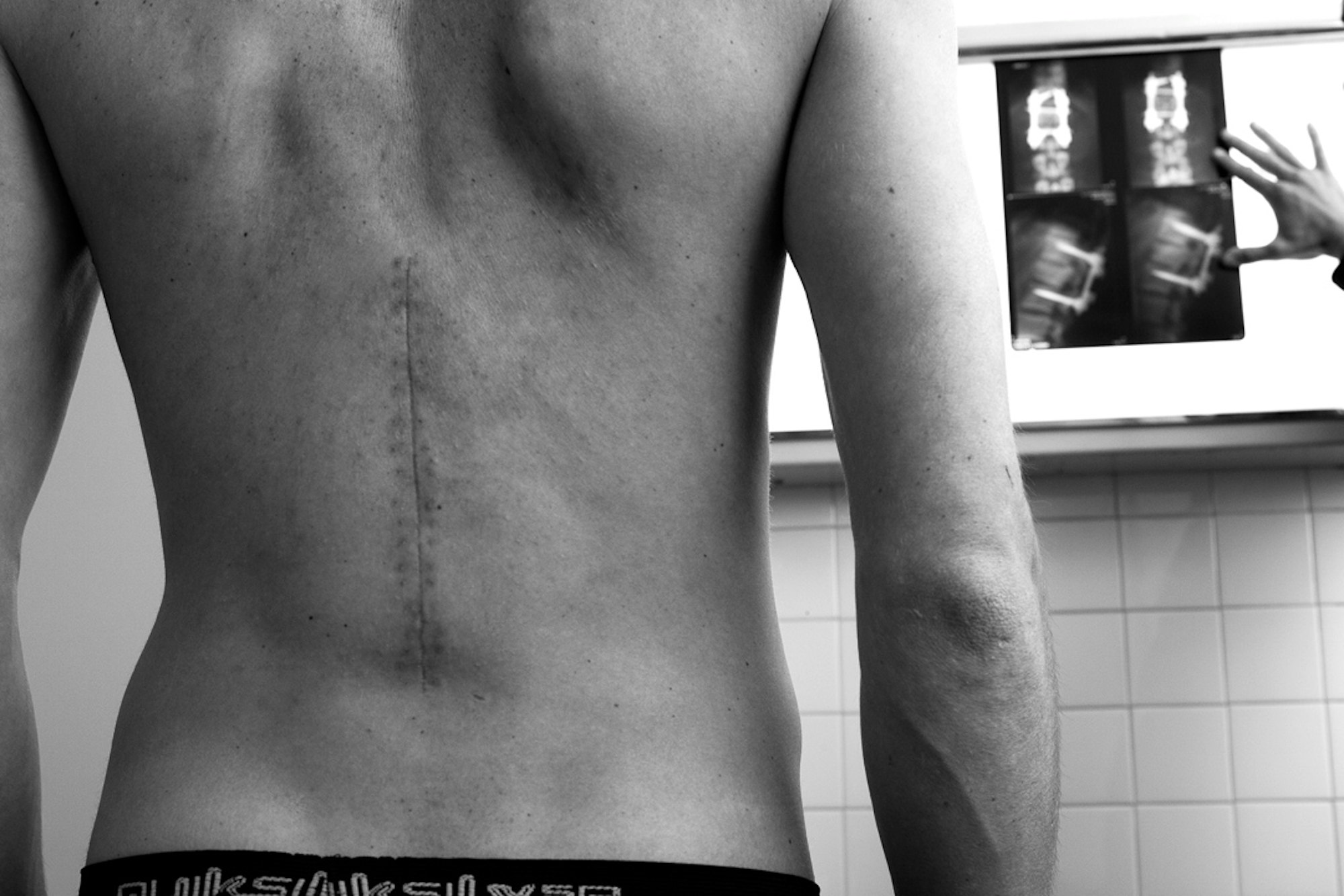 1080_candidethovex_scar_christoffersjostromquiksilver