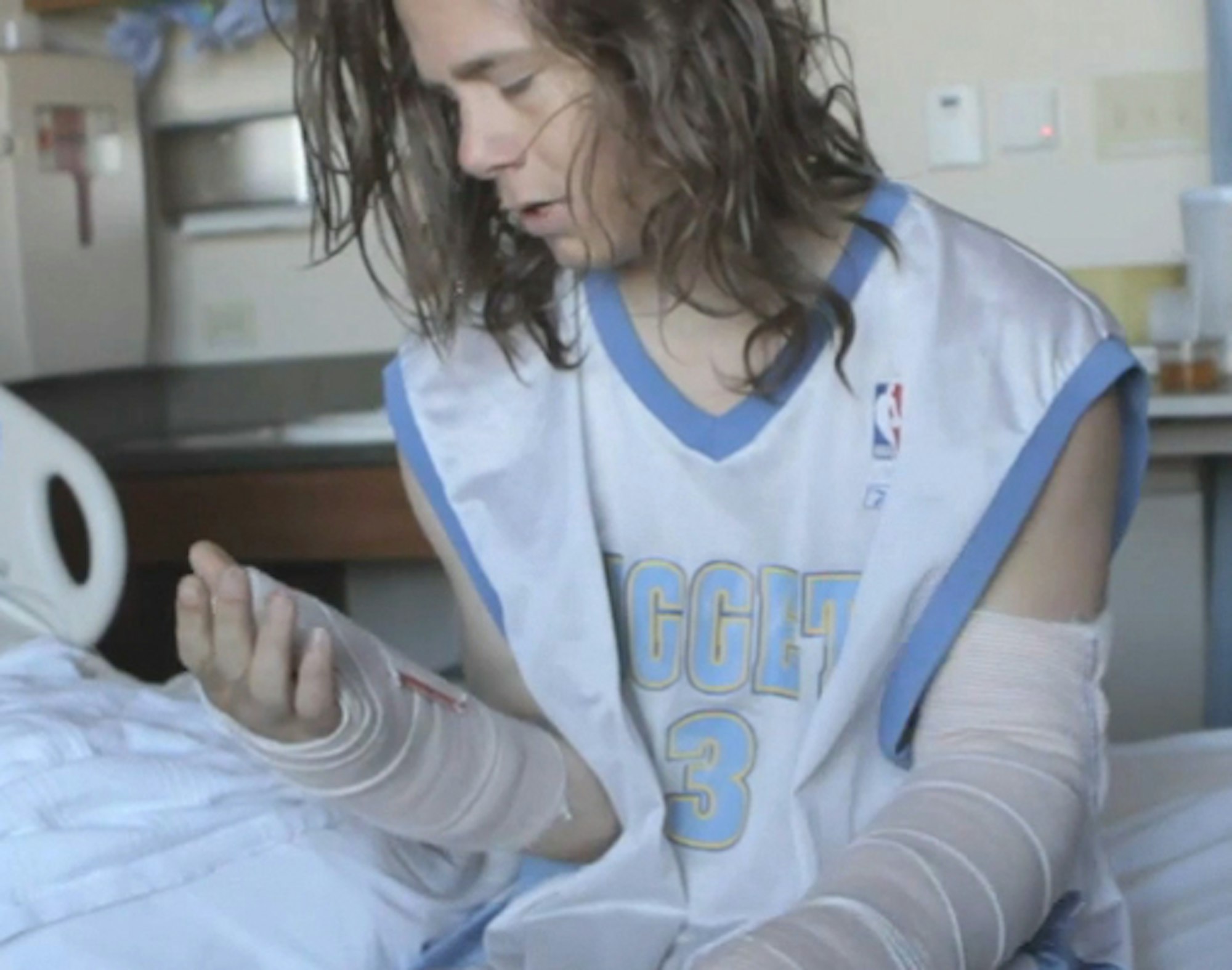 Charlie Owens takes nasty spill shooting with Stept, breaks both arms