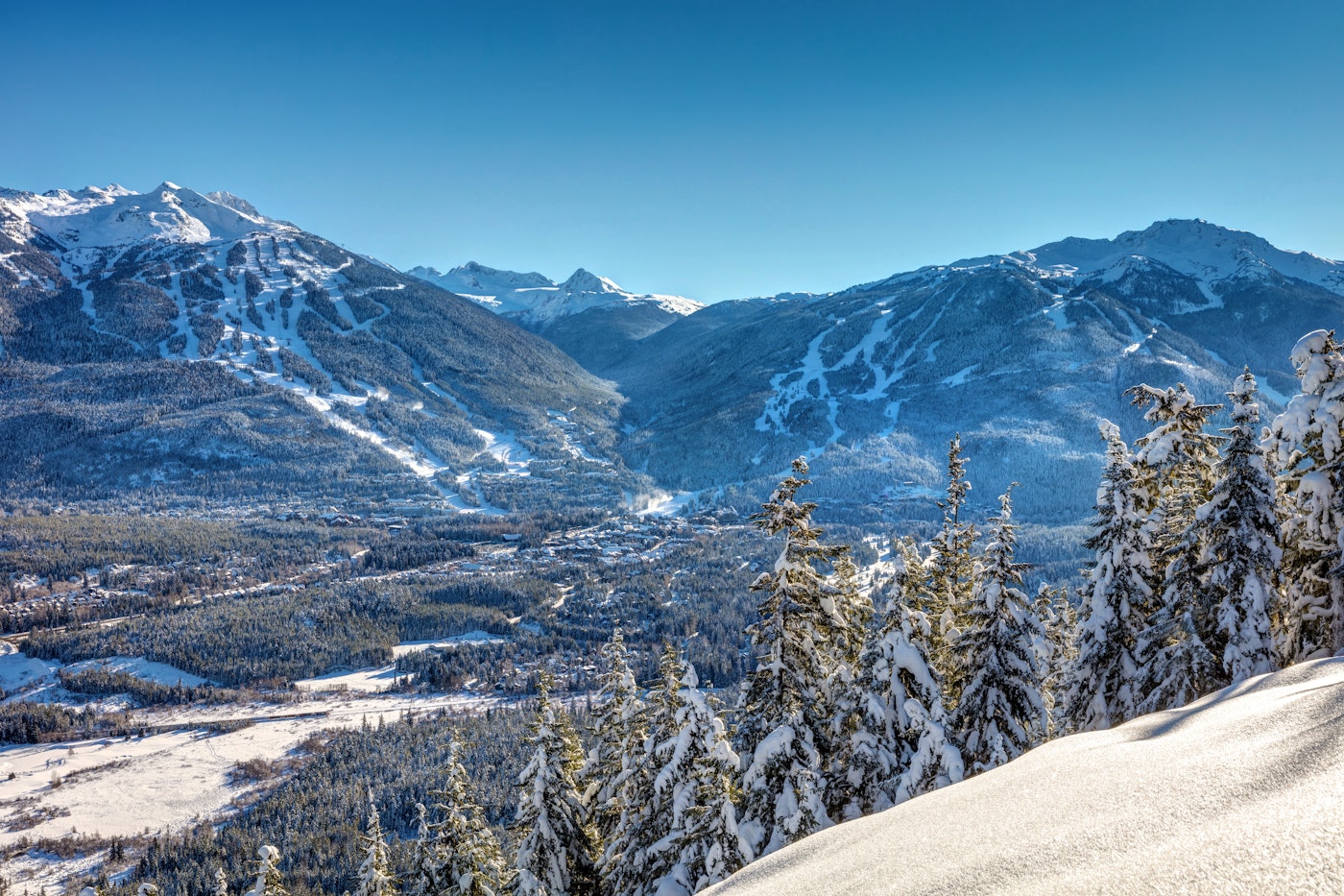 Whistler Blackcomb Resort