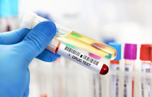 drug and alcohal test