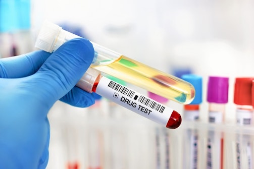drug and alcohal test