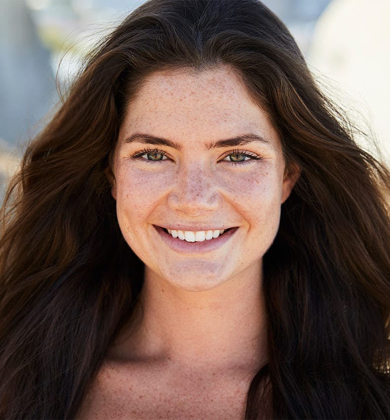 woman with freckles smiling forward