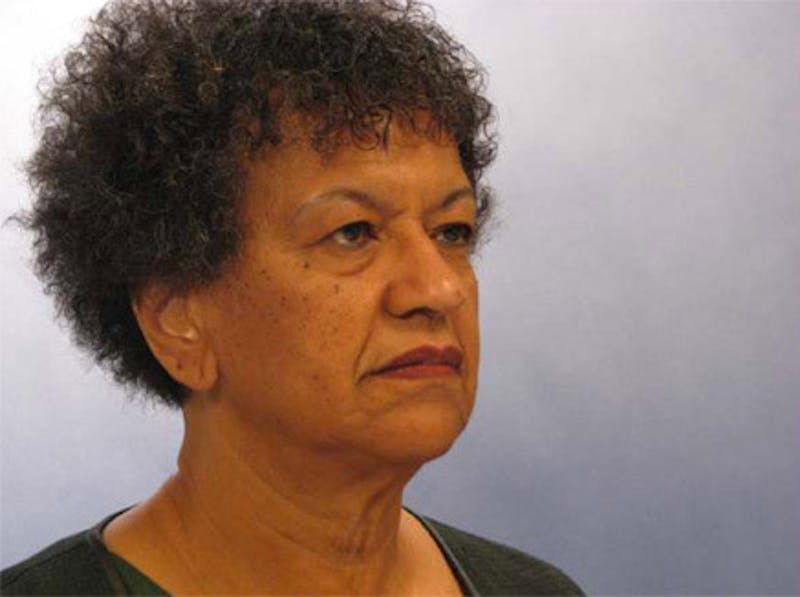 Facelift Before & After Gallery - Patient 461832 - Image 3