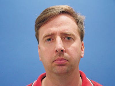 Facelift Before & After Gallery - Patient 557264 - Image 1