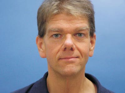 Facelift Before & After Gallery - Patient 418821 - Image 1