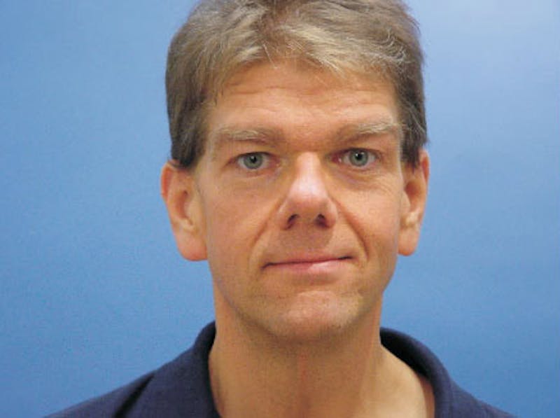 Facelift Before & After Gallery - Patient 418821 - Image 1