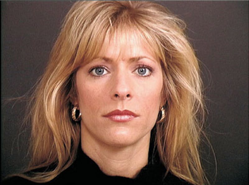 Primary Rhinoplasty Before & After Gallery - Patient 376764 - Image 1