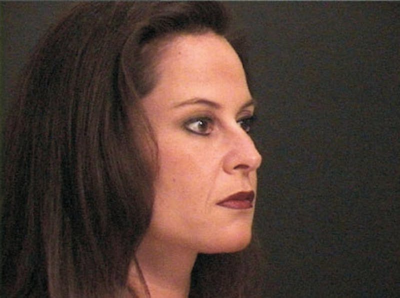 Primary Rhinoplasty Before & After Gallery - Patient 414739 - Image 3