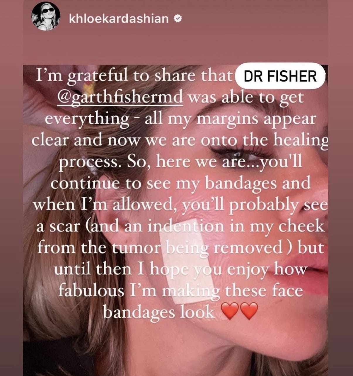 Khloe Instagram Post