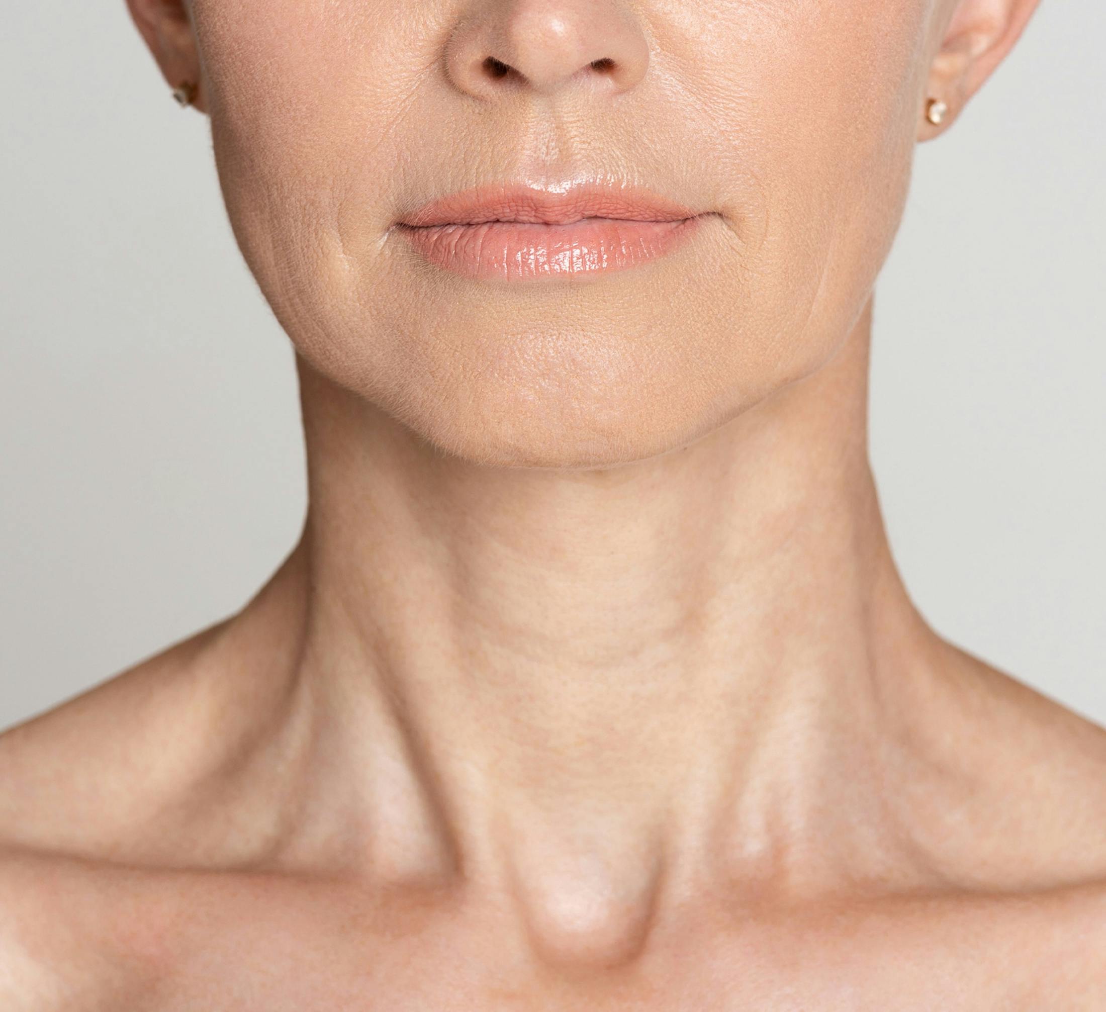 neck lift in Newport Beach