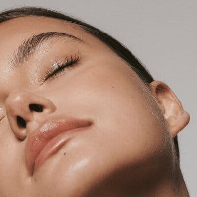 Featured in TZR The Pros Say That Your Skin's Red, Bumpy Patch Might Not be a Breakout