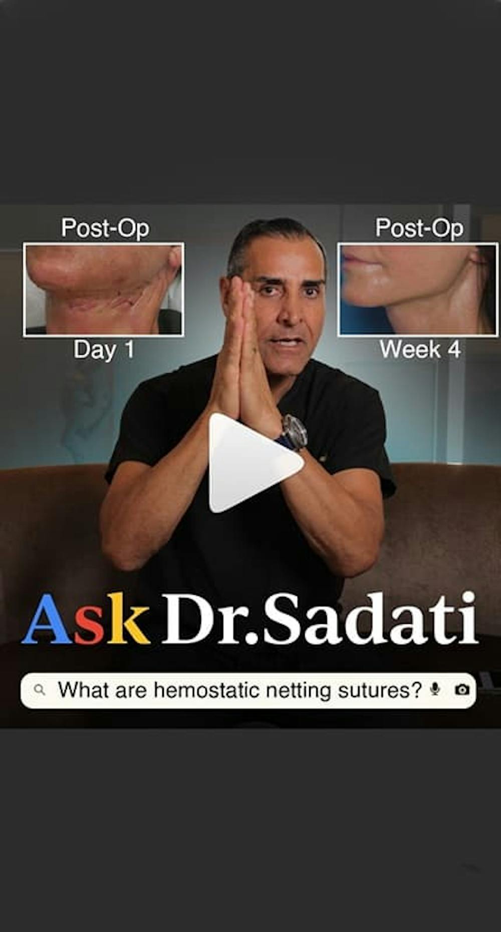 10 cosas que debes saber antes de hacerte un lifting facial: la guía experta del Dr. Kevin Sadati