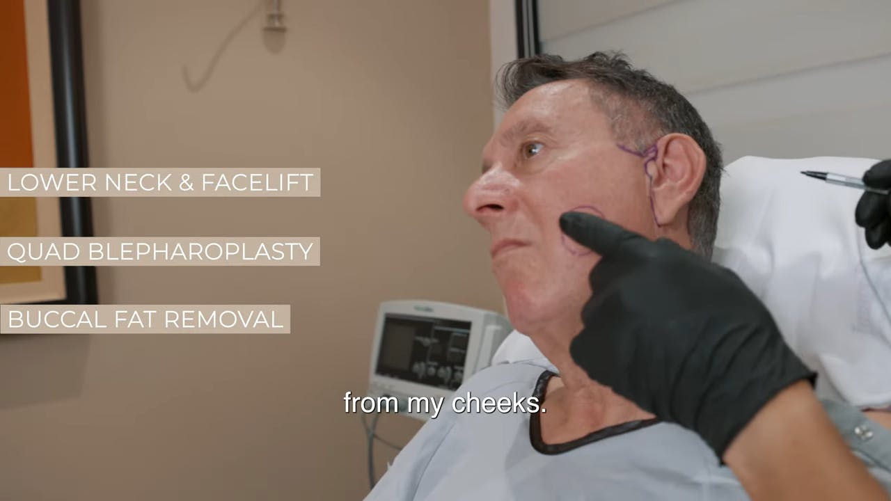 3 Common Treatments Used During Facelift Surgery