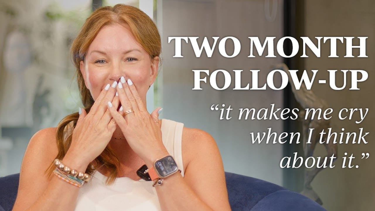Real Patient Facelift Testimonial