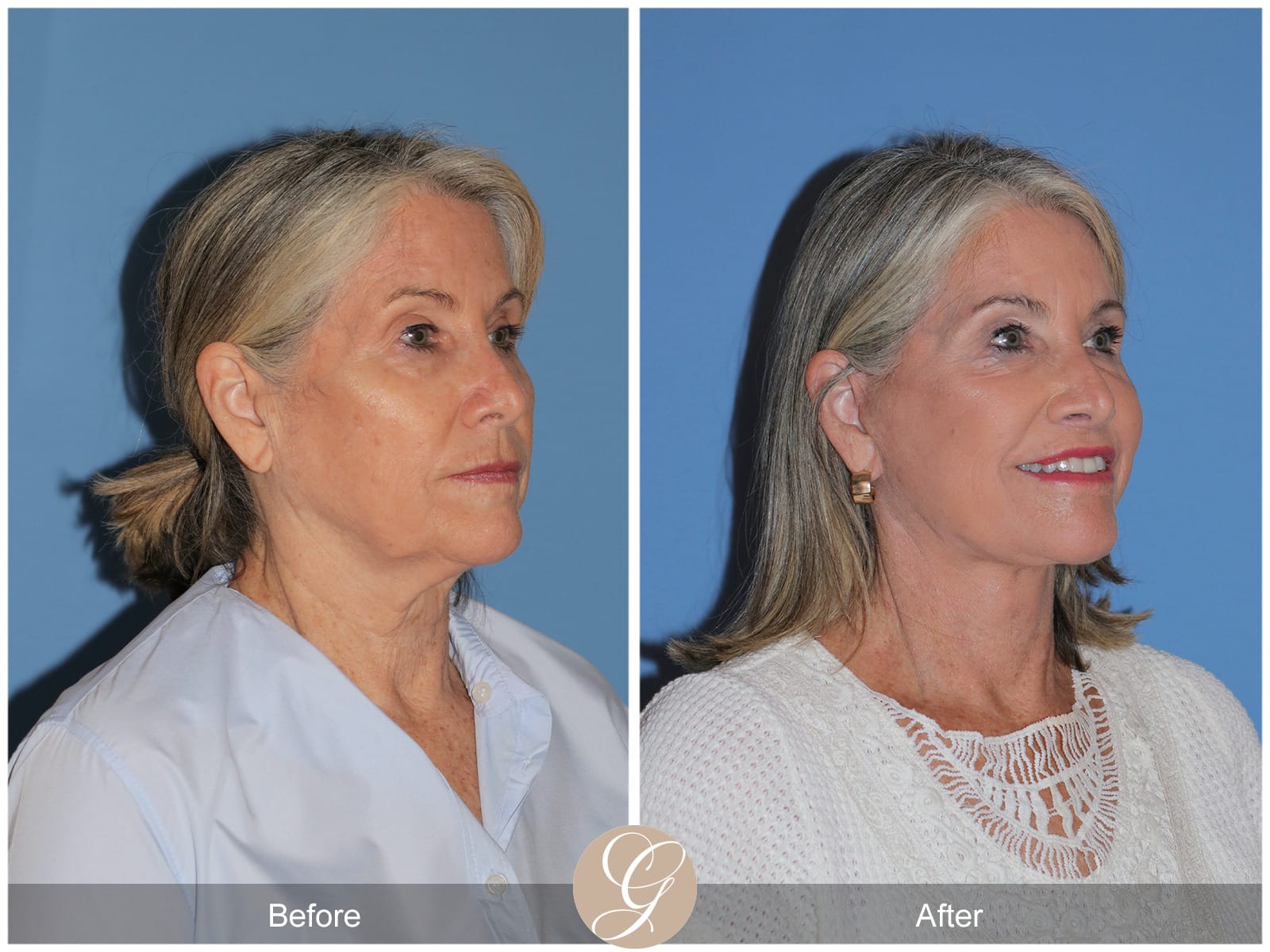 sam mcdadi plastic surgery Image 6
