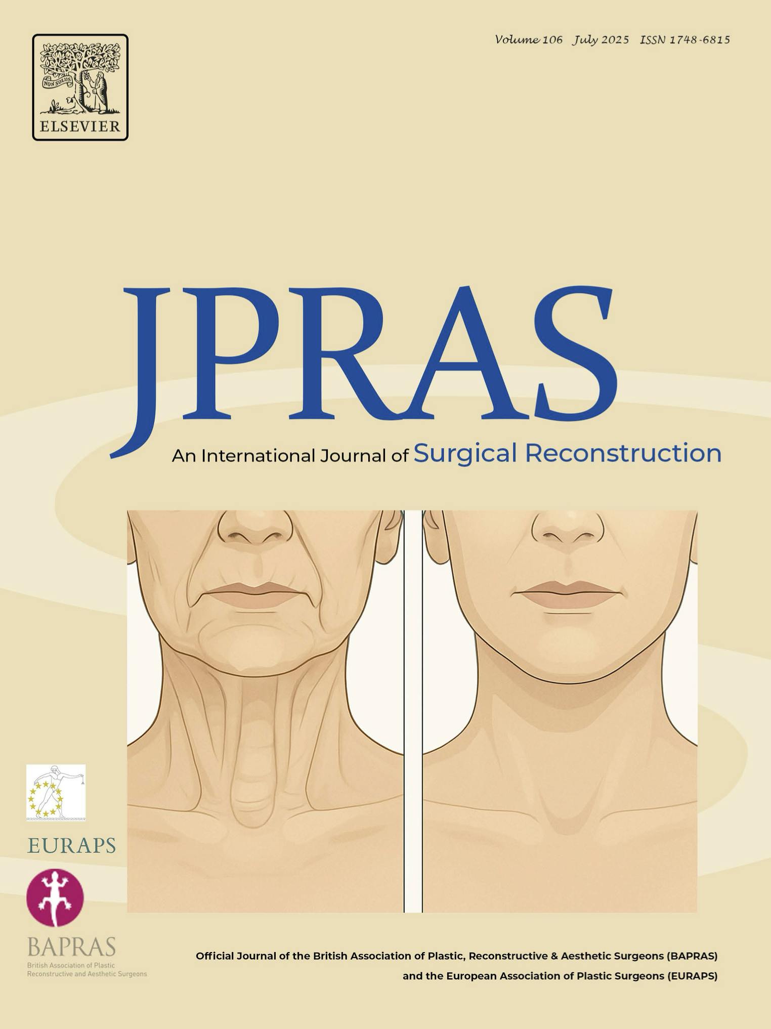 Deep Neck Surgery in Deep Plane Facelifts - Learning from Evidence and Experience