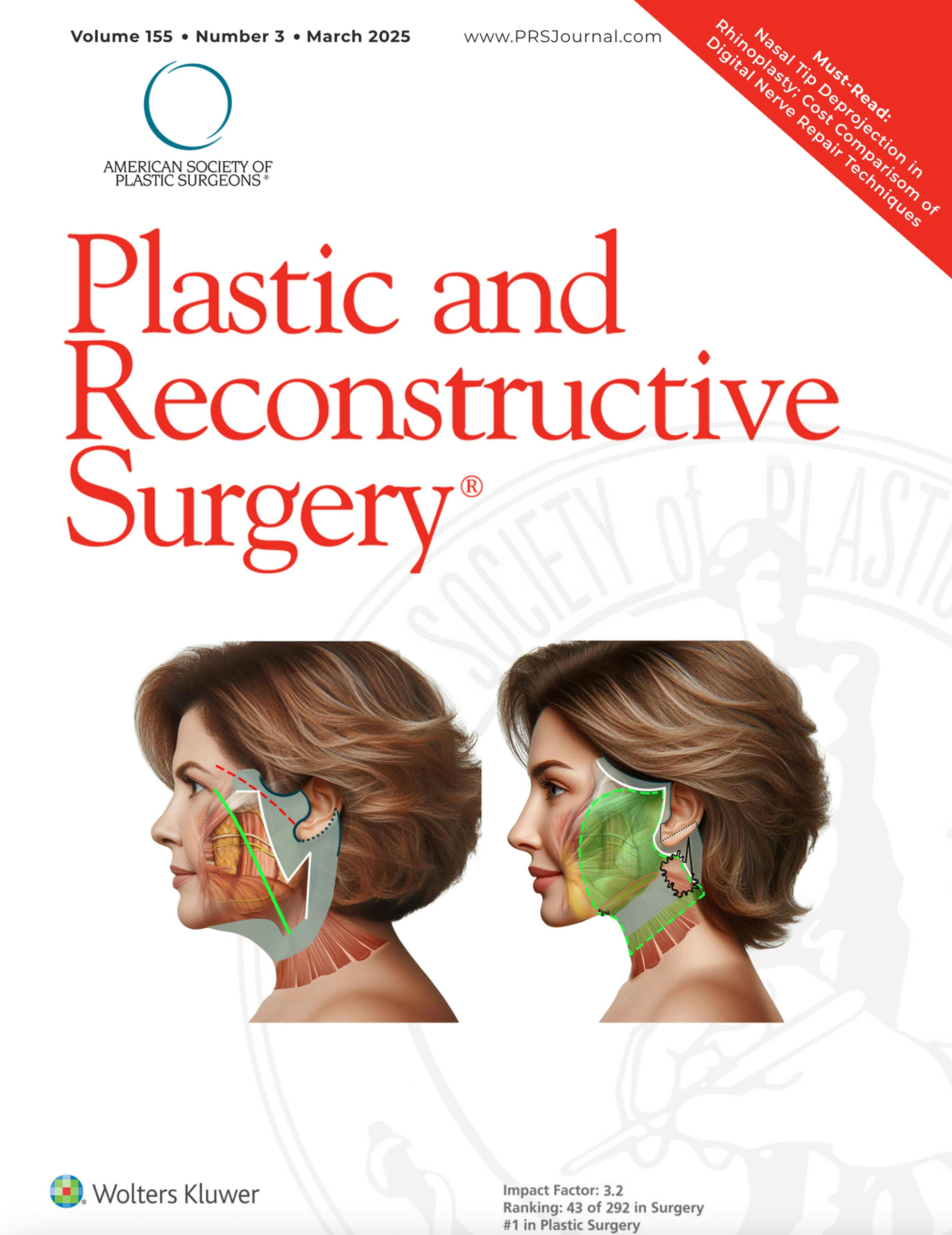 Advancements in Facelift Techniques: Preservation Facelift with a Rotating Pedicle Flap