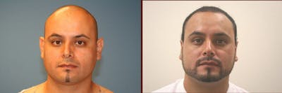 Ear Surgery Before & After Gallery - Patient 101584 - Image 1
